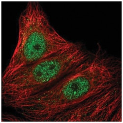 ARMC5 Antibody, Novus Biologicals 25 &mu;L:Antibodies, Polyclonal