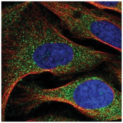 ARMC7 Antibody, Novus Biologicals 100&mu;L; Unlabeled:Antibodies, Polyclonal