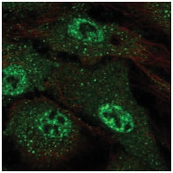 ARMCX4 Antibody, Novus Biologicals 100&mu;L; Unlabeled:Antibodies, Polyclonal