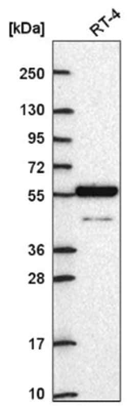 ARNTL2 Antibody, Novus Biologicals:Antibodies:Primary Antibodies
