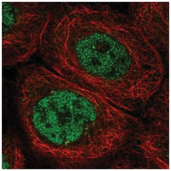 Artemis Antibody, Novus Biologicals 25 &mu;L, Unlabeled:Antibodies, Polyclonal