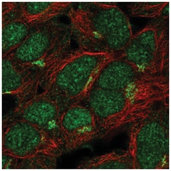 ASB13 Antibody, Novus Biologicals 25 &mu;L, Unlabeled:Antibodies, Polyclonal