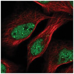 ASC1 Antibody, Novus Biologicals:Antibodies:Primary Antibodies