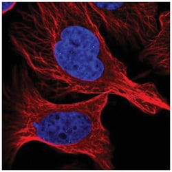 ASCIZ Antibody, Novus Biologicals 100&mu;L; Unlabeled:Antibodies, Polyclonal