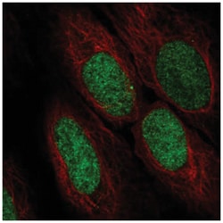 ASF1a Antibody, Novus Biologicals 25 &mu;L, Unlabeled:Antibodies, Polyclonal
