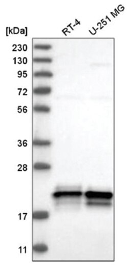 ASF1a Antibody, Novus Biologicals 25 &mu;L, Unlabeled:Antibodies, Polyclonal