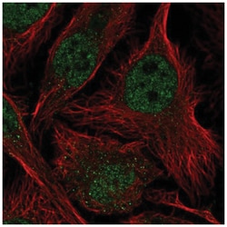 ASF1b Antibody, Novus Biologicals 100&mu;L; Unlabeled:Antibodies, Polyclonal