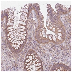 ASK1 Antibody, Novus Biologicals 25 &mu;L, Unlabeled:Antibodies, Polyclonal