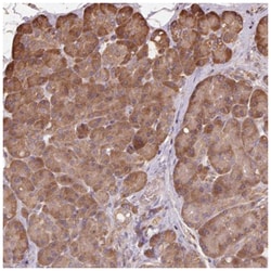 ASK1 Antibody, Novus Biologicals:Antibodies:Primary Antibodies