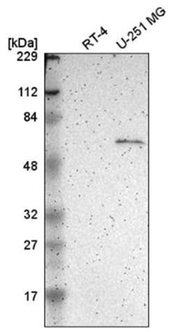 Asparagine synthetase Antibody, Novus Biologicals:Antibodies:Primary Antibodies