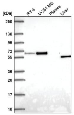 Asparagine synthetase Antibody, Novus Biologicals 25 &mu;L, Unlabeled:Antibodies,