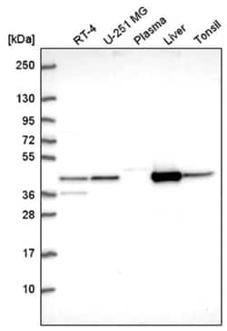 Aspartate Aminotransferase Antibody, Novus Biologicals 100&mu;L; Unlabeled:Antibodies,