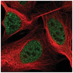 ASXL2 Antibody, Novus Biologicals 25 &mu;L, Unlabeled:Antibodies, Polyclonal