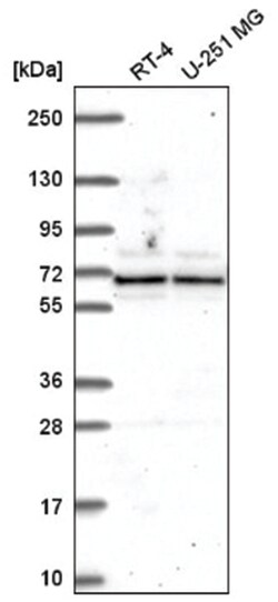 ATAD3A Antibody, Novus Biologicals 100&mu;L; Unlabeled:Antibodies, Polyclonal