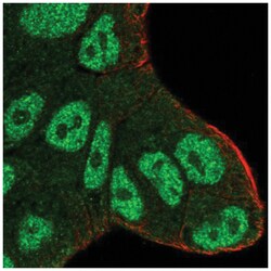 Ataxin 1 Antibody, Novus Biologicals:Antibodies:Primary Antibodies