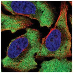 Ataxin-2-like protein Antibody, Novus Biologicals:Antibodies:Primary Antibodies