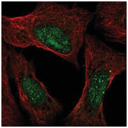 Ataxin-3 Antibody, Novus Biologicals 100&mu;L; Unlabeled:Antibodies, Polyclonal