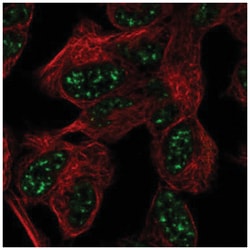Ataxin 7-Like 3 Antibody, Novus Biologicals 25 &mu;L:Antibodies, Polyclonal