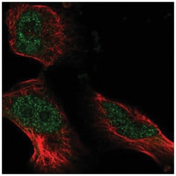 ATE1 Antibody, Novus Biologicals 100&mu;L; Unlabeled:Antibodies, Polyclonal