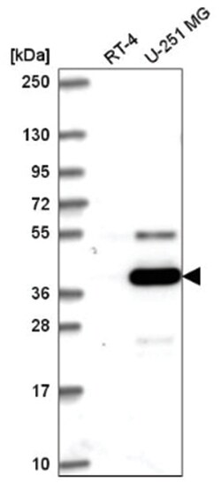 ATG4A Antibody, Novus Biologicals 100&mu;L; Unlabeled:Antibodies, Polyclonal
