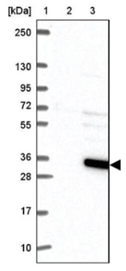 ATG5 Antibody, Novus Biologicals:Antibodies:Primary Antibodies
