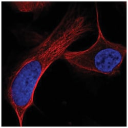 ATM Antibody, Novus Biologicals 100&mu;L; Unlabeled:Antibodies, Polyclonal