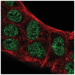 ATOH8 Antibody, Novus Biologicals:Antibodies:Primary Antibodies