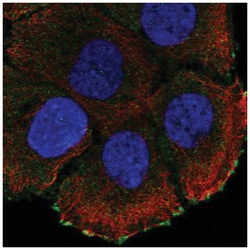 ATP2C2 Antibody, Novus Biologicals 25 &mu;L, Unlabeled:Antibodies, Polyclonal