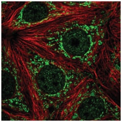 ATP5J2 Antibody, Novus Biologicals:Antibodies:Primary Antibodies