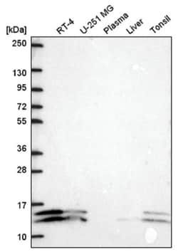 ATP5J2 Antibody, Novus Biologicals 100&mu;L; Unlabeled:Antibodies, Polyclonal