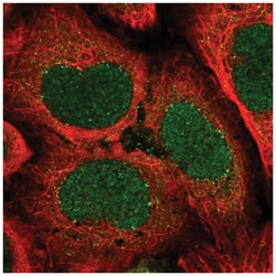 ATP6V1A Antibody, Novus Biologicals 25 &mu;L:Antibodies, Polyclonal