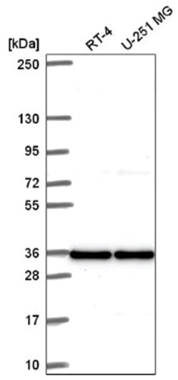 ATP6V1C1 Antibody, Novus Biologicals 100&mu;L; Unlabeled:Antibodies, Polyclonal