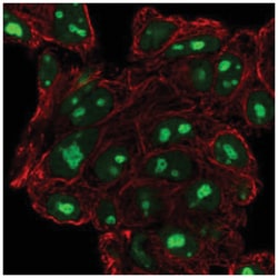 ATPBD4 Antibody, Novus Biologicals 100&mu;L; Unlabeled:Antibodies, Polyclonal