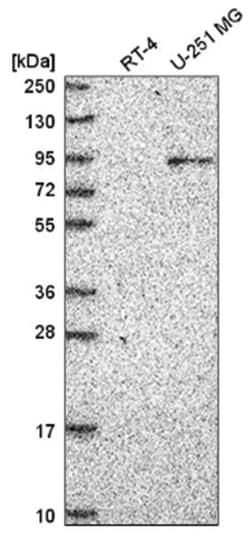 ATRIP Antibody, Novus Biologicals 25 &mu;L:Antibodies, Polyclonal