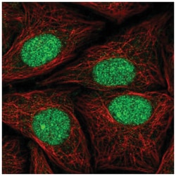 ATXN1L Antibody, Novus Biologicals 25 &mu;L, Unlabeled:Antibodies, Polyclonal