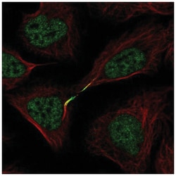 Aurora B Antibody, Novus Biologicals 100&mu;L; Unlabeled:Antibodies, Polyclonal