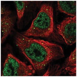 AXUD1 Antibody, Novus Biologicals 25 &mu;L, Unlabeled:Antibodies, Polyclonal