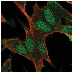 BAALC Antibody, Novus Biologicals 100&mu;L; Unlabeled:Antibodies, Polyclonal