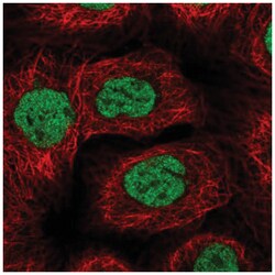 BACH1 Antibody, Novus Biologicals 100&mu;L; Unlabeled:Antibodies, Polyclonal