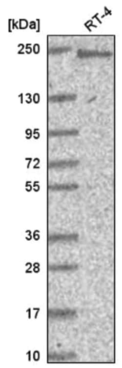 BAF180/PB1 Antibody, Novus Biologicals 100 &mu;L | Buy Online | Novus Biologicals | Fisher Scientific