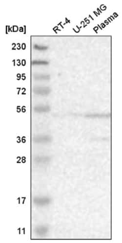 BAF53A Antibody, Novus Biologicals 100&mu;L; Unlabeled:Antibodies, Polyclonal
