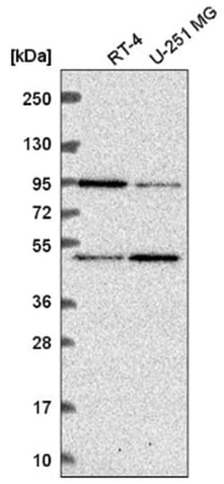 BAL/PARP9 Antibody, Novus Biologicals:Antibodies:Primary Antibodies