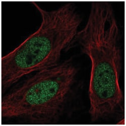 BAP1 Antibody, Novus Biologicals 100&mu;L; Unlabeled:Antibodies, Polyclonal