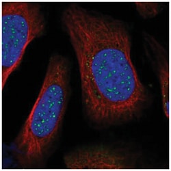 BARD1 Antibody, Novus Biologicals 25 &mu;L:Antibodies, Polyclonal