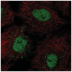 BarX1 Antibody, Novus Biologicals:Antibodies:Primary Antibodies