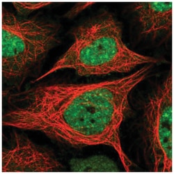 BAZ2A Antibody, Novus Biologicals 25 &mu;L:Antibodies, Polyclonal