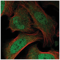 BAZ2B Antibody, Novus Biologicals 100&mu;L; Unlabeled:Antibodies, Polyclonal