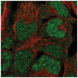 BCCIP Antibody, Novus Biologicals 100&mu;L; Unlabeled:Antibodies, Polyclonal