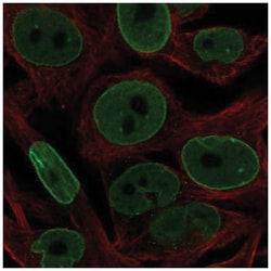 Bcl-2 Antibody, Novus Biologicals:Antibodies:Primary Antibodies