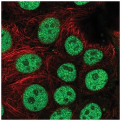 BCL7C Antibody, Novus Biologicals:Antibodies:Primary Antibodies